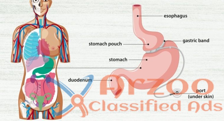 Best obesity treatment in kanpur Shivani Hospital