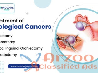 Find the best urologist near me for Prostate cance