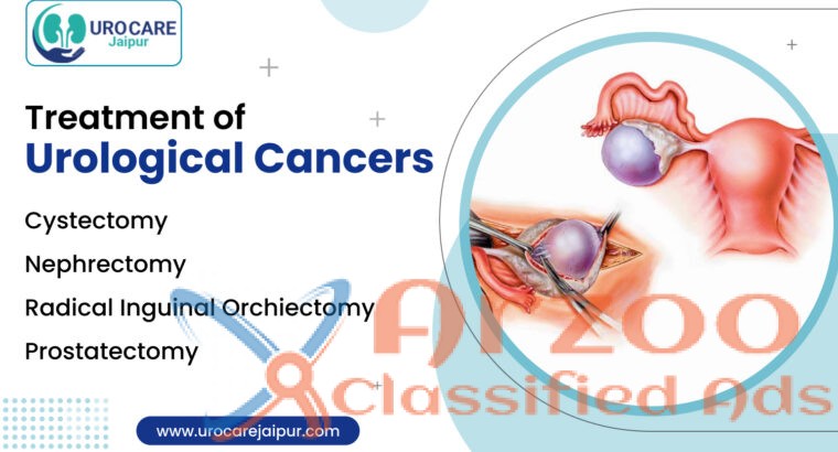 Find the best urologist near me for Prostate cance